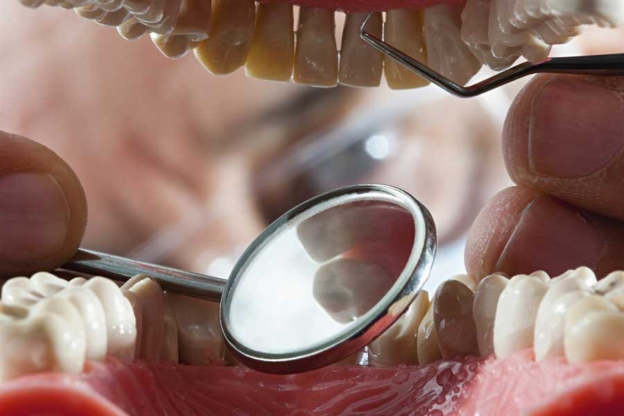 Dental Care Products, Oral Hygiene, Dental Problems & Diseases Remedies